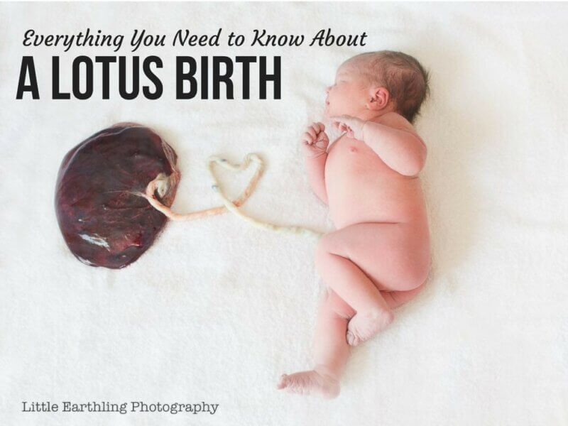Everything You Need To Know About A Lotus Birth Baby Care Mag Everything You Need To Know About A Lotus Birth Baby Care Mag